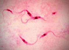 Varios ejemplares de este tipo de parásito donde la parte coloreada de rosa oscuro es su material genético 